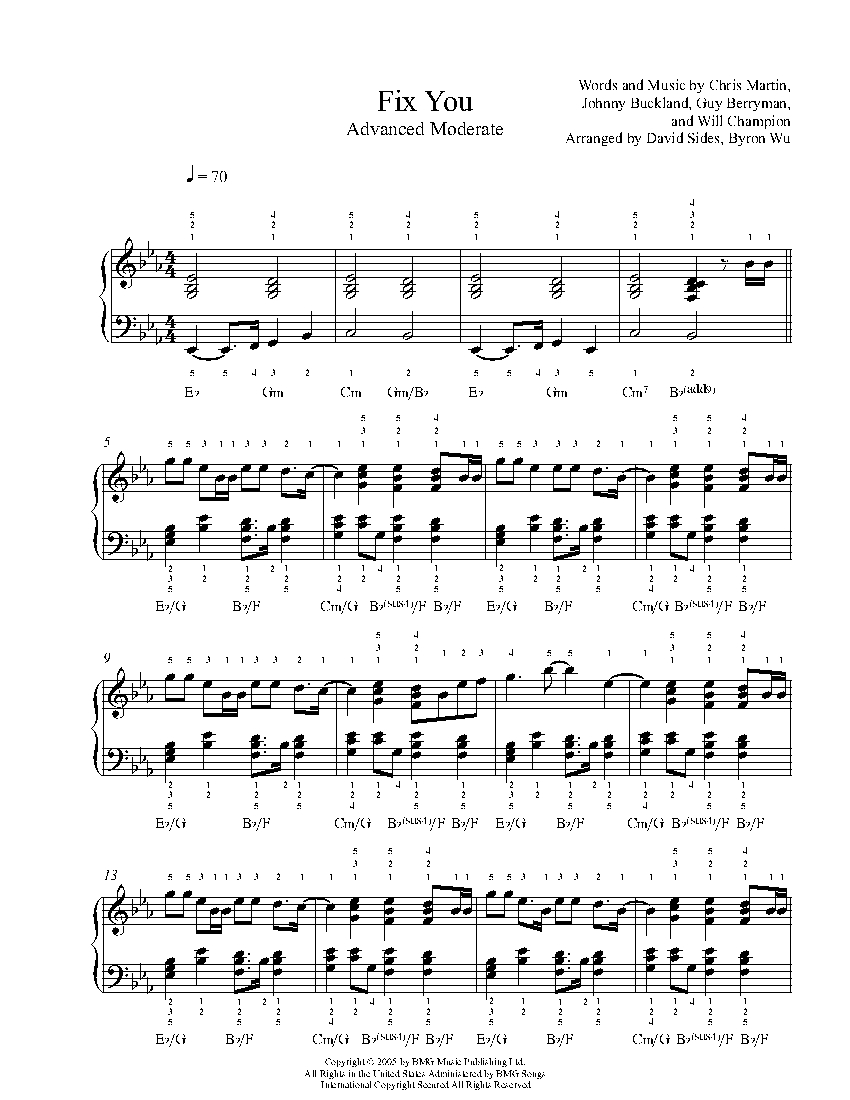 Fix You by Coldplay Piano Sheet Music | Advanced Level